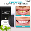 Set 14 Benzi pentru Albirea Dintilor Teno471, IVISMILE, Carbune Activ si PAP, 7 Plicuri